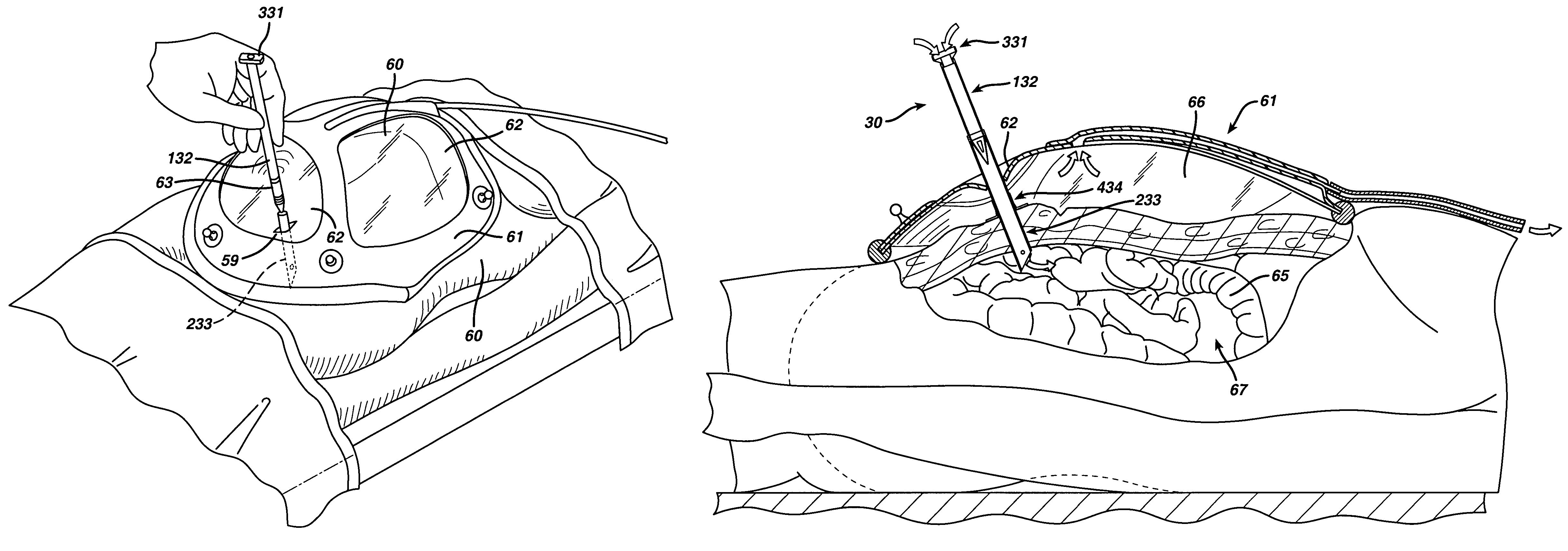 Method for accessing an operative space