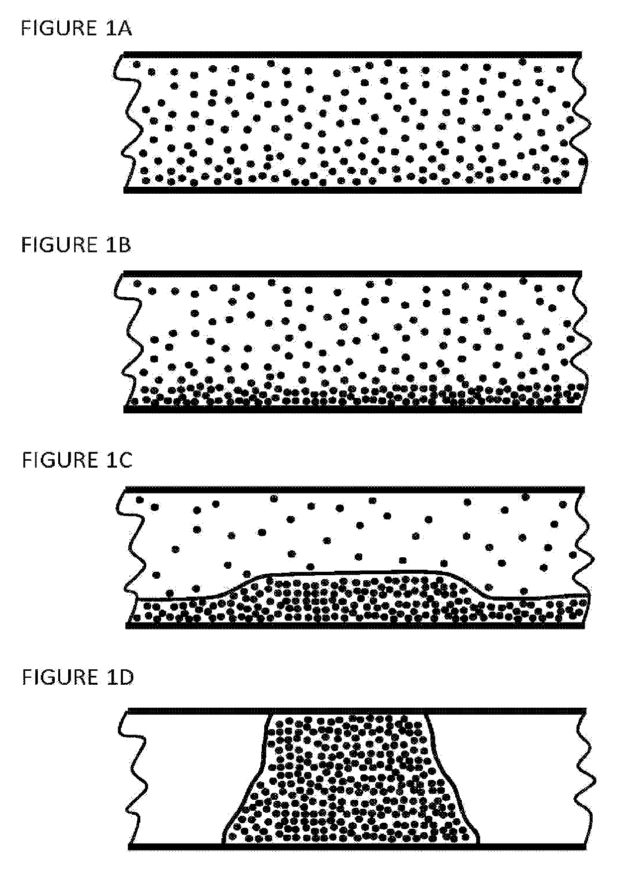 Dense phase material transport in pulmonary system