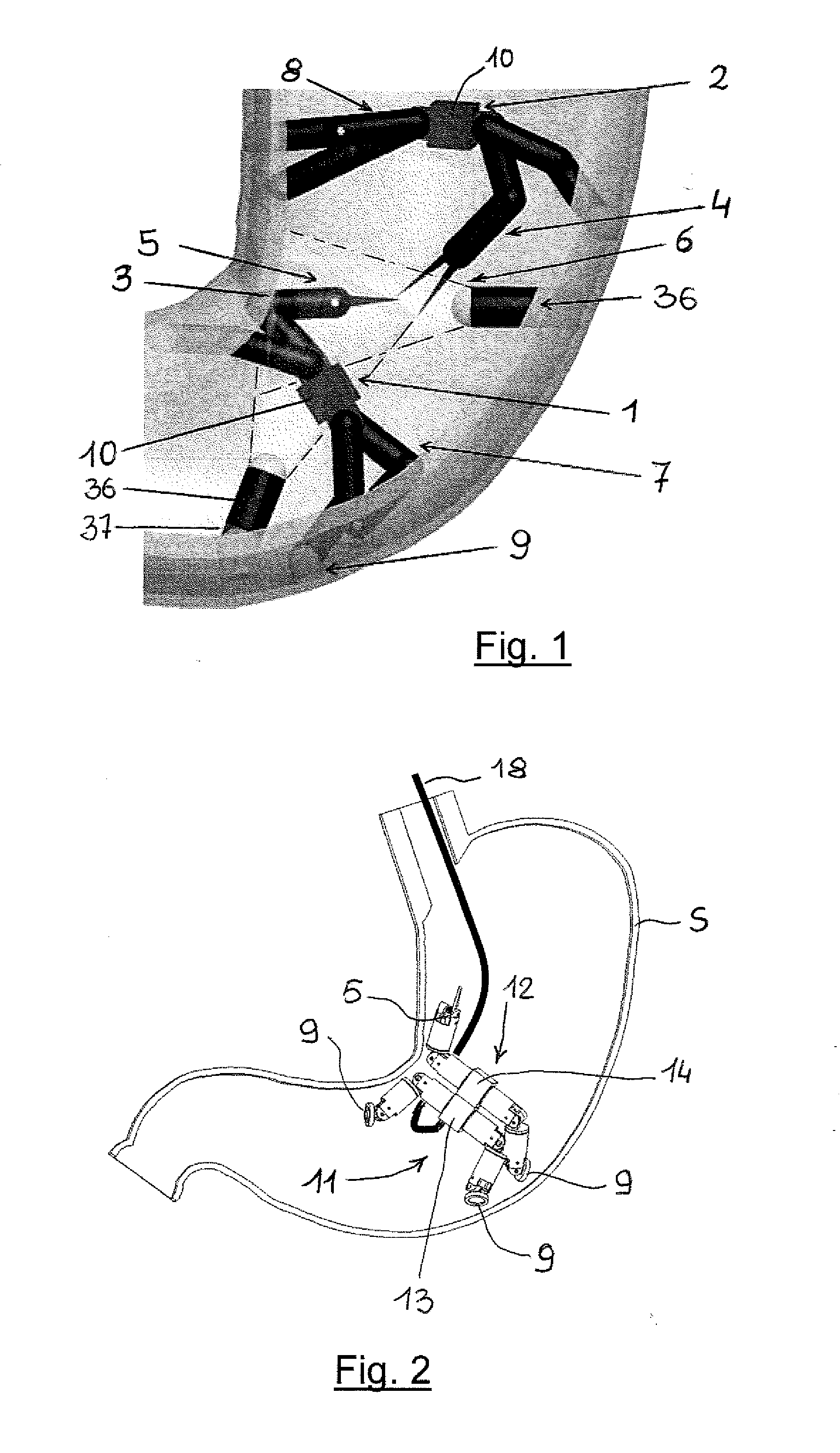 Endoluminal robotic system