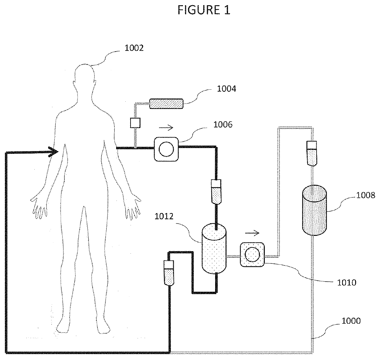 Galectin-3 plasmapheresis therapy