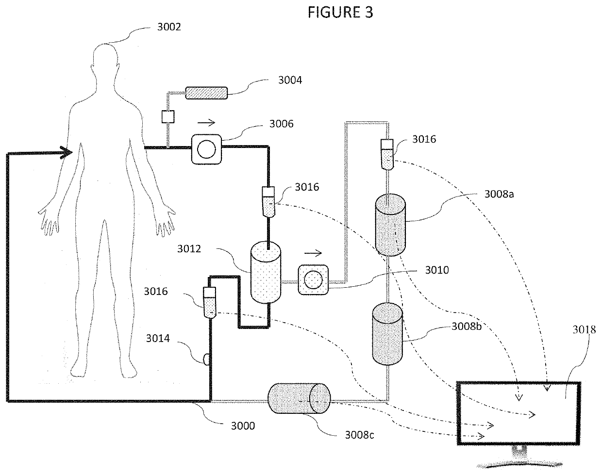 Galectin-3 plasmapheresis therapy