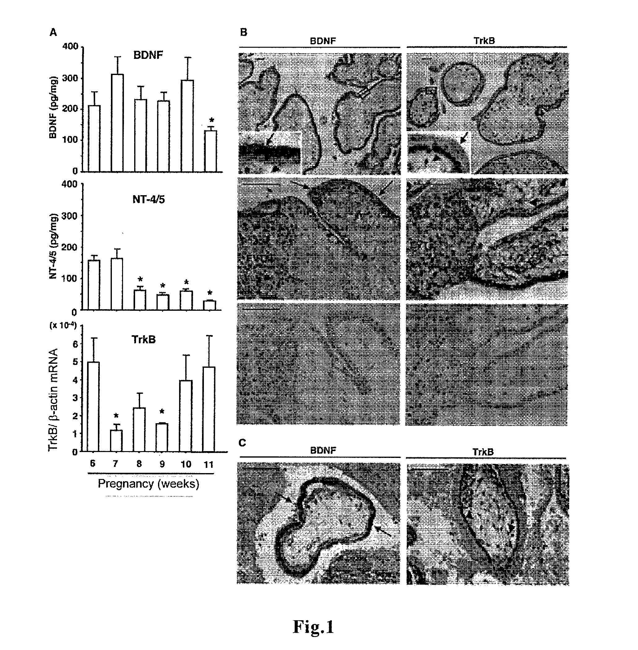 Therapeutic agent for ectopic pregnancy