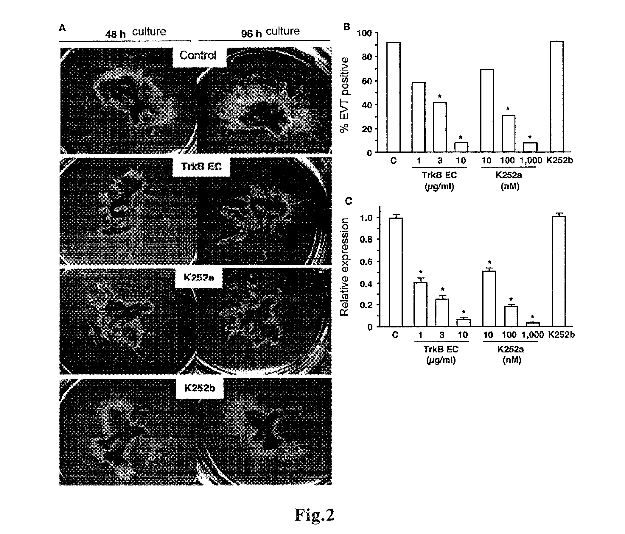 Therapeutic agent for ectopic pregnancy