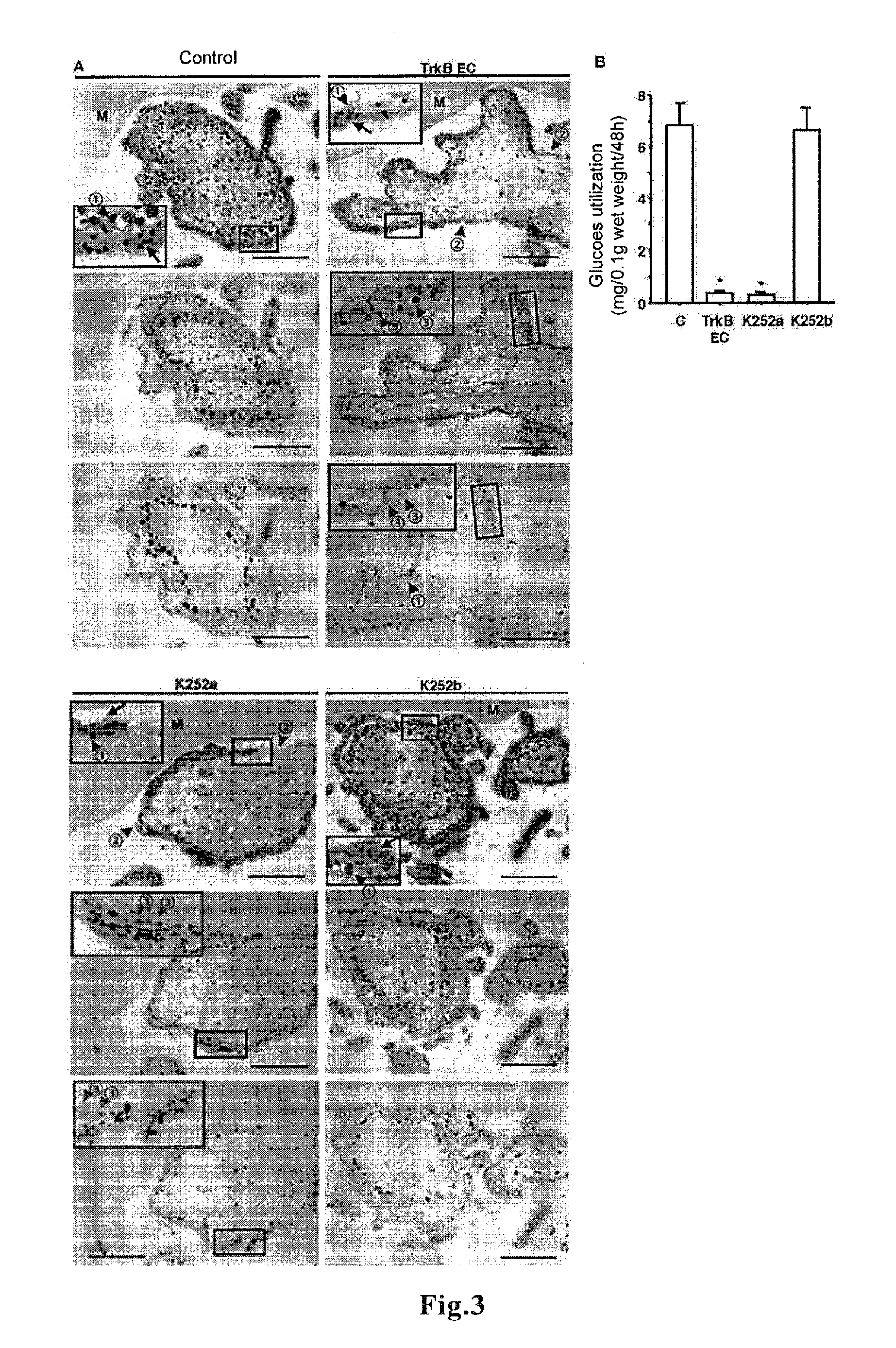 Therapeutic agent for ectopic pregnancy