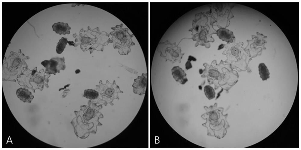 Compound feed for breeding larvaeof tropical sea cucumbers in planktonic period and preparation method of compound feed