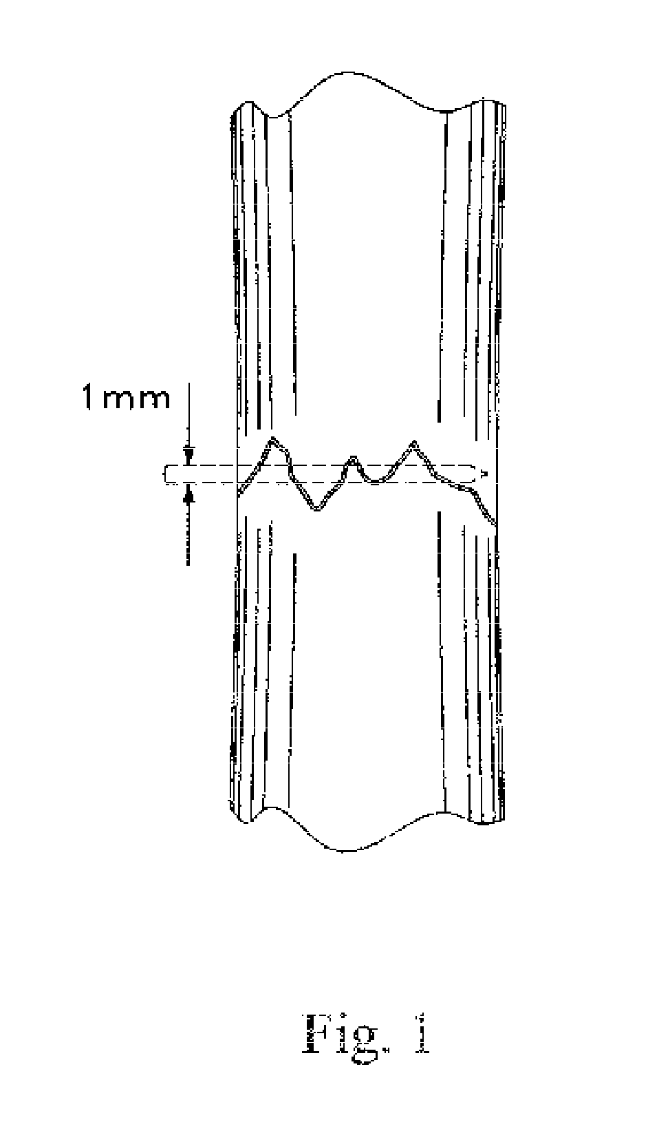 Methods and kits for treating fractures with a biological agent