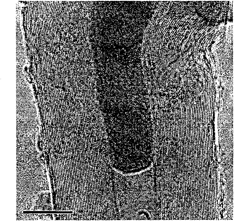 Method for preparing carbon nanometer tube/hydroxyapatite complex powder through in-situ vapour deposition reaction