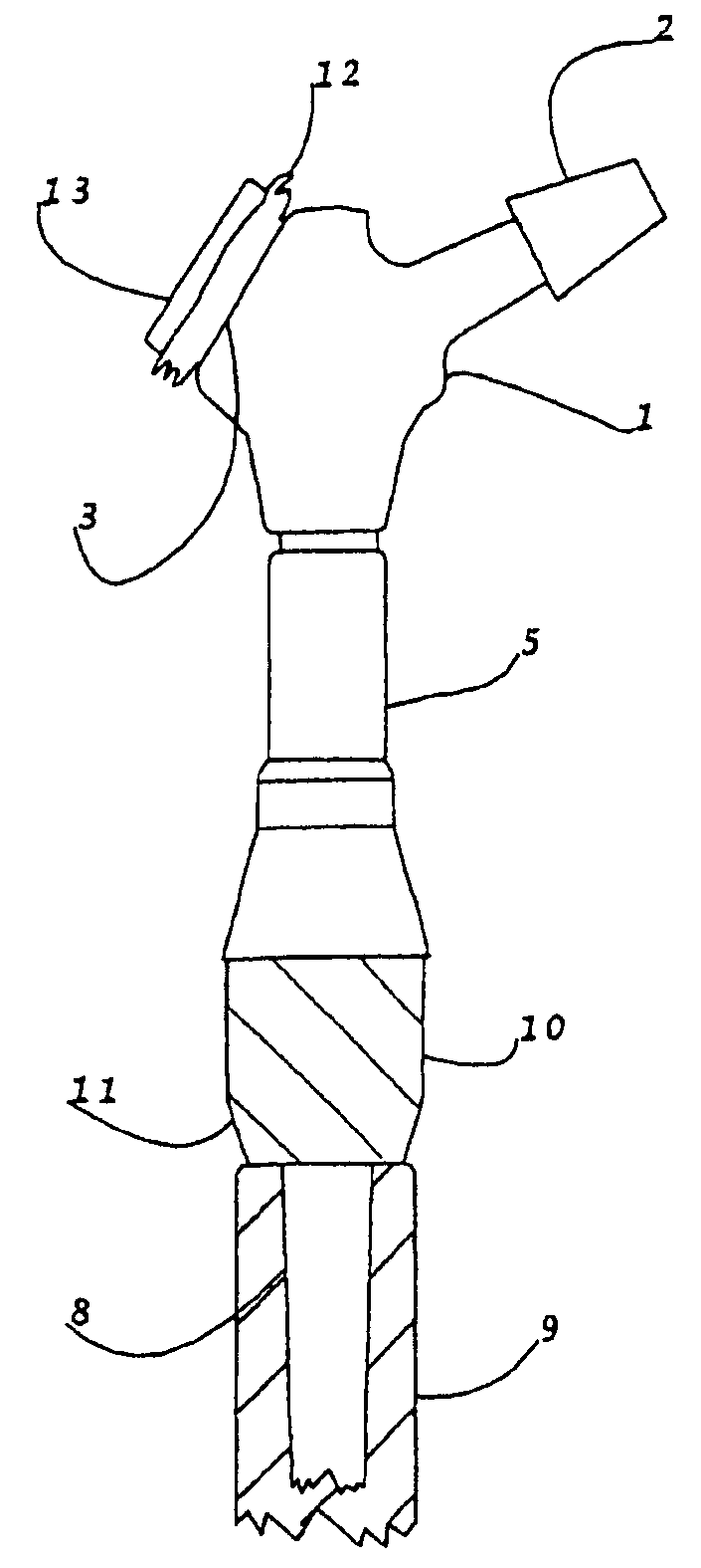 Modular long bone prosthesis