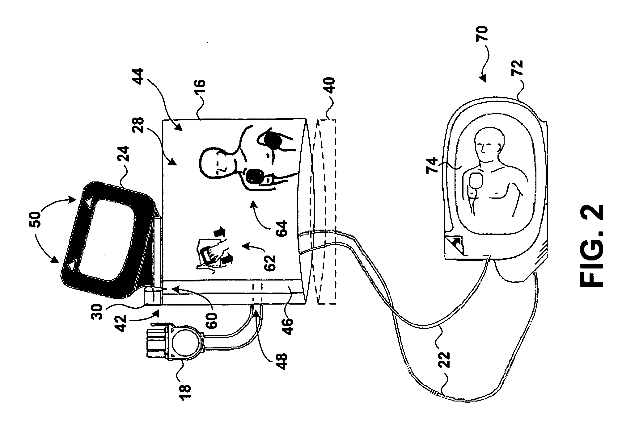 Easy-to-use electrode and package