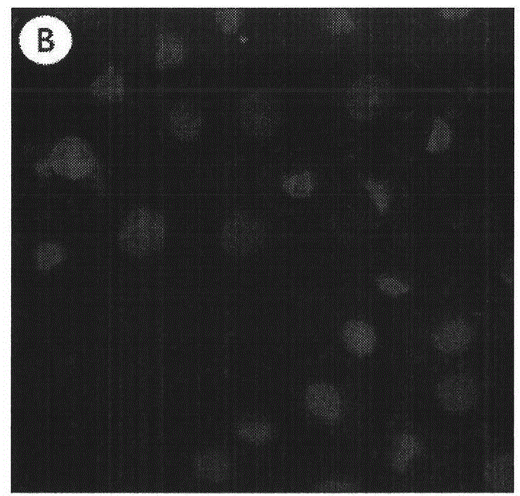 Oleanolic acid polycystic lipidosome and preparation method and application thereof