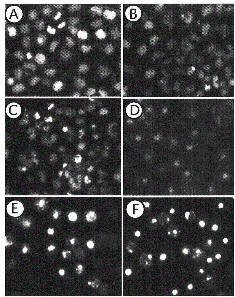 Oleanolic acid polycystic lipidosome and preparation method and application thereof