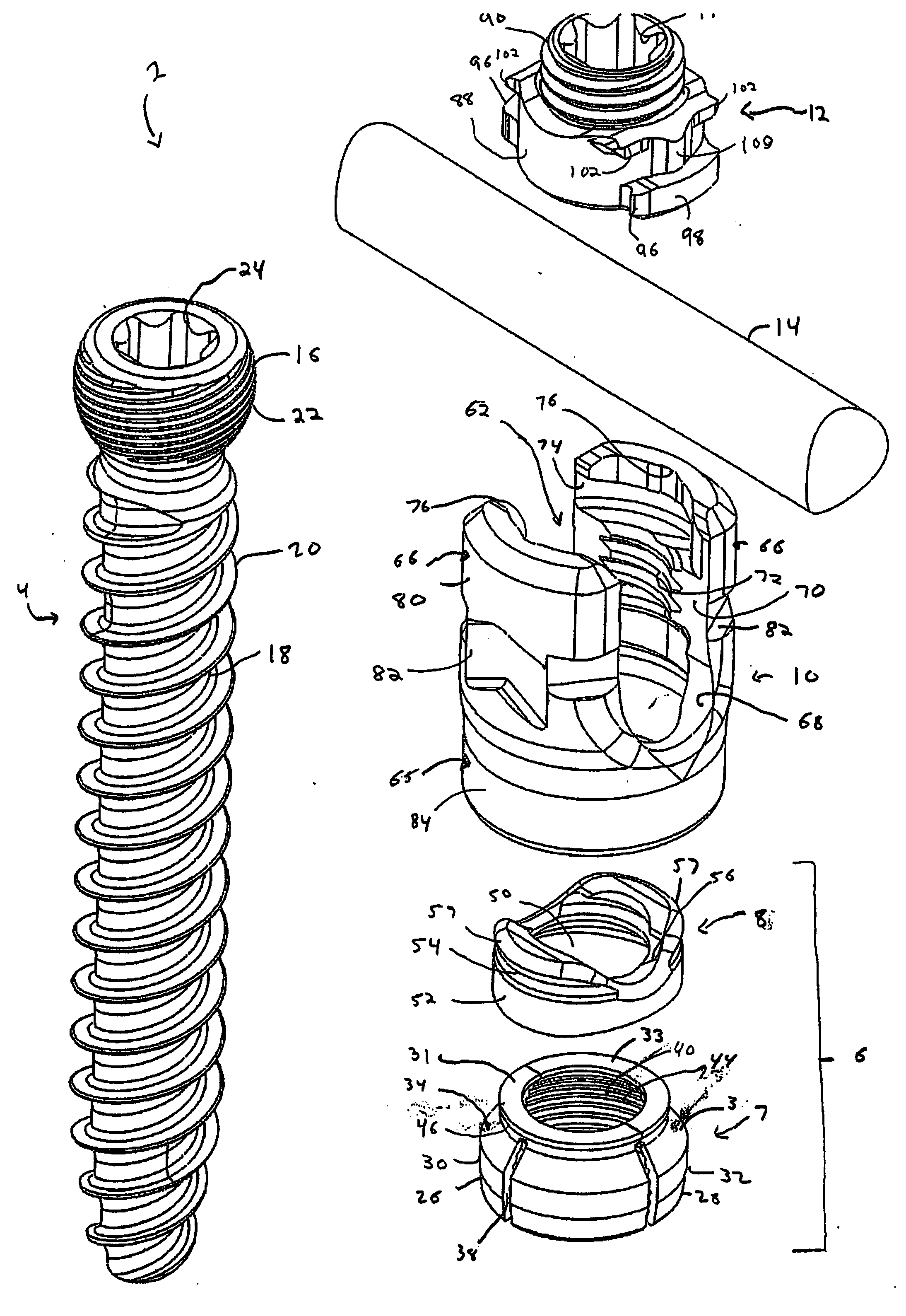 Orthopedic Fixation Devices and Methods of Installation Thereof