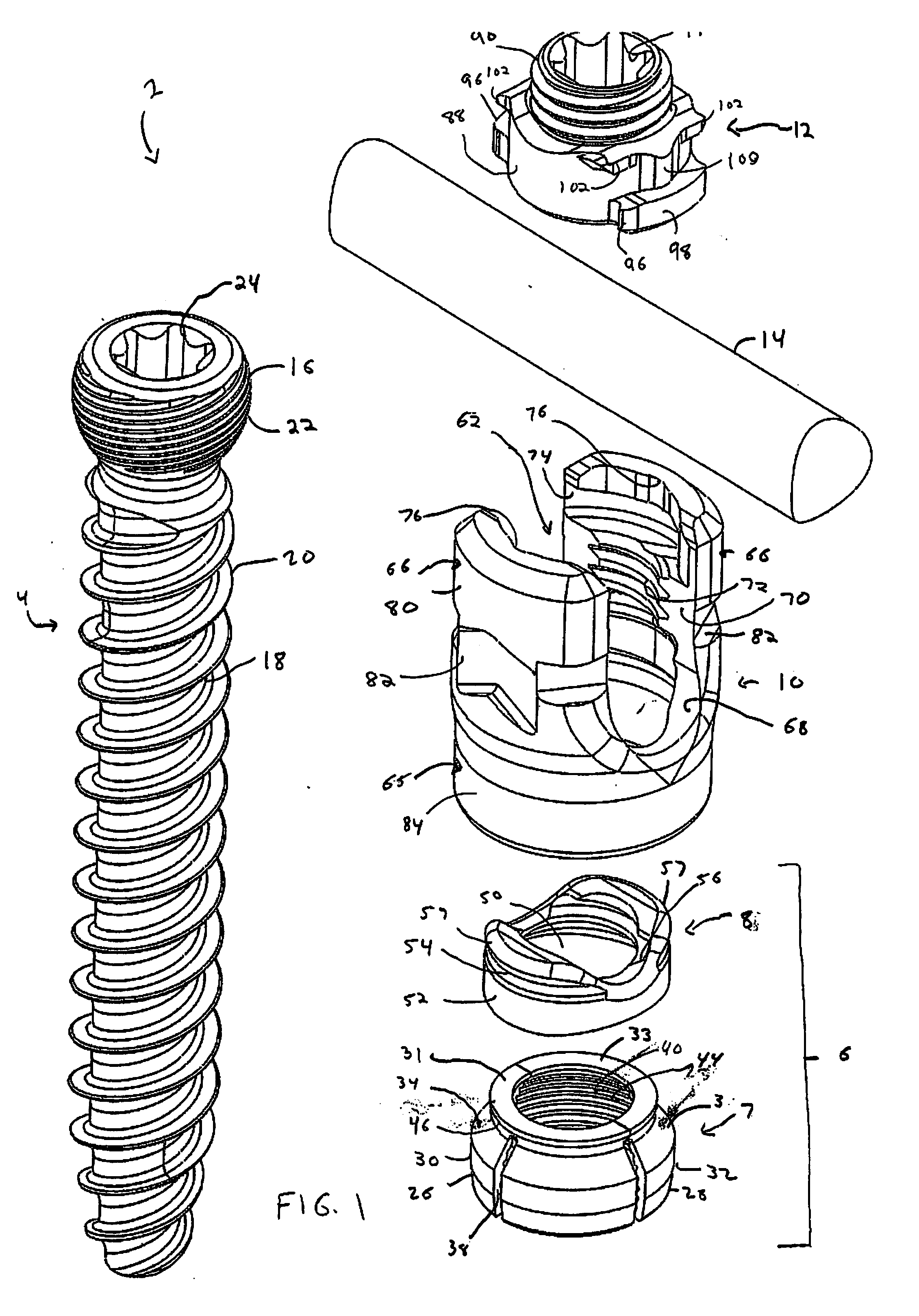 Orthopedic Fixation Devices and Methods of Installation Thereof