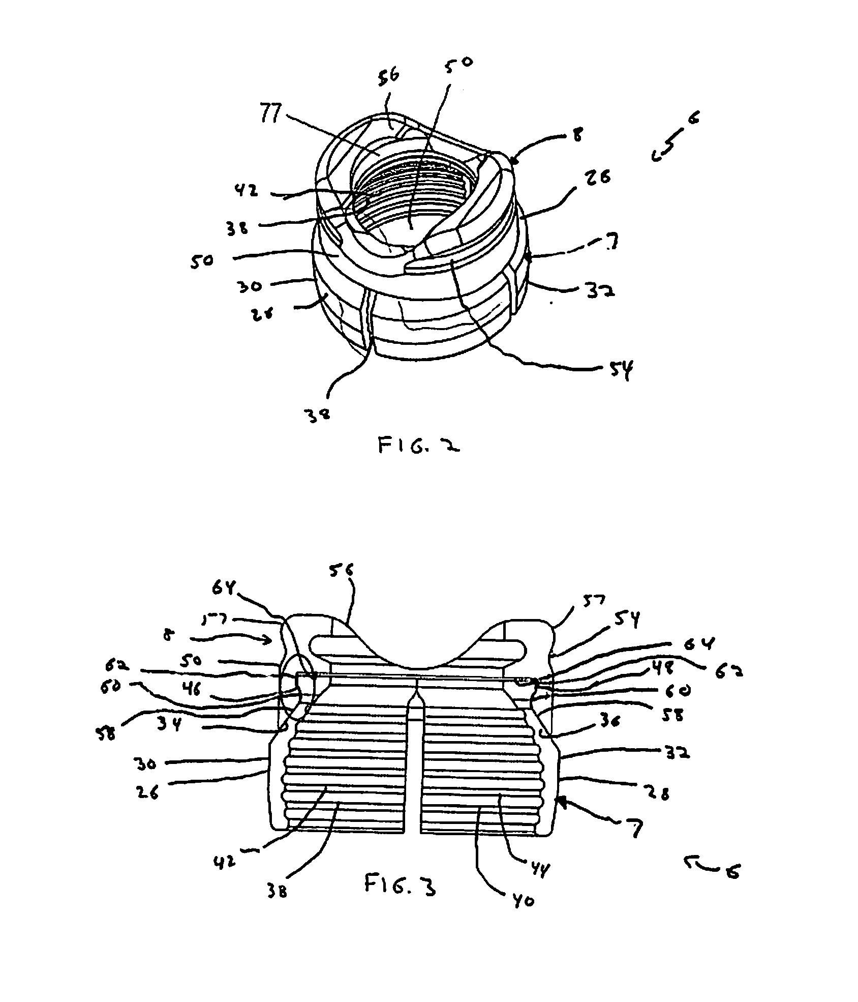 Orthopedic Fixation Devices and Methods of Installation Thereof