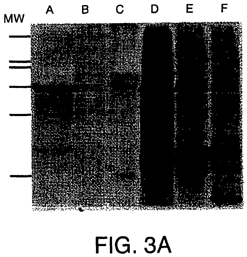 Nucleotide and protein sequence of mammastatin and methods of use