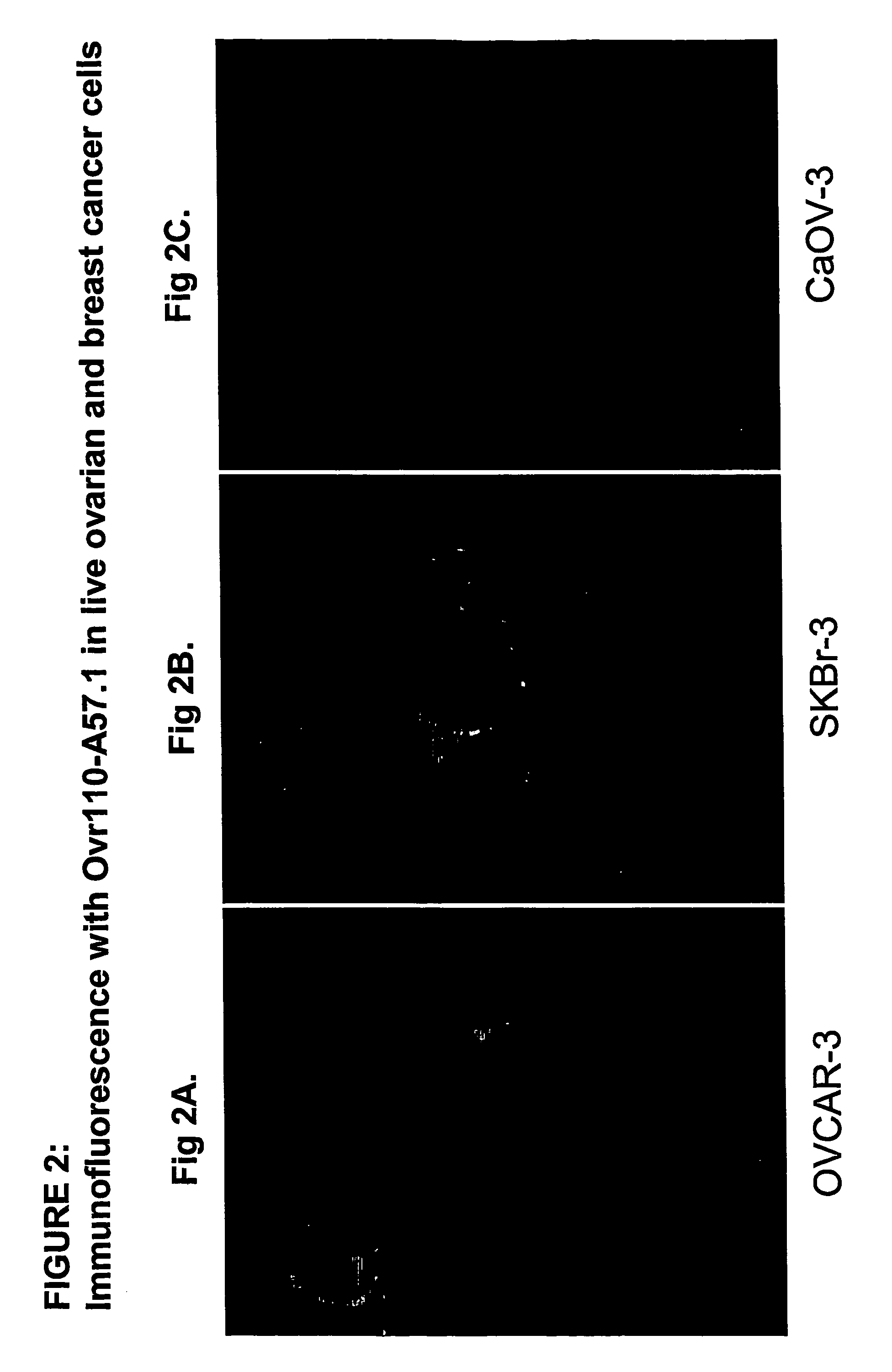 Ovr110 antibody compositions and methods of use