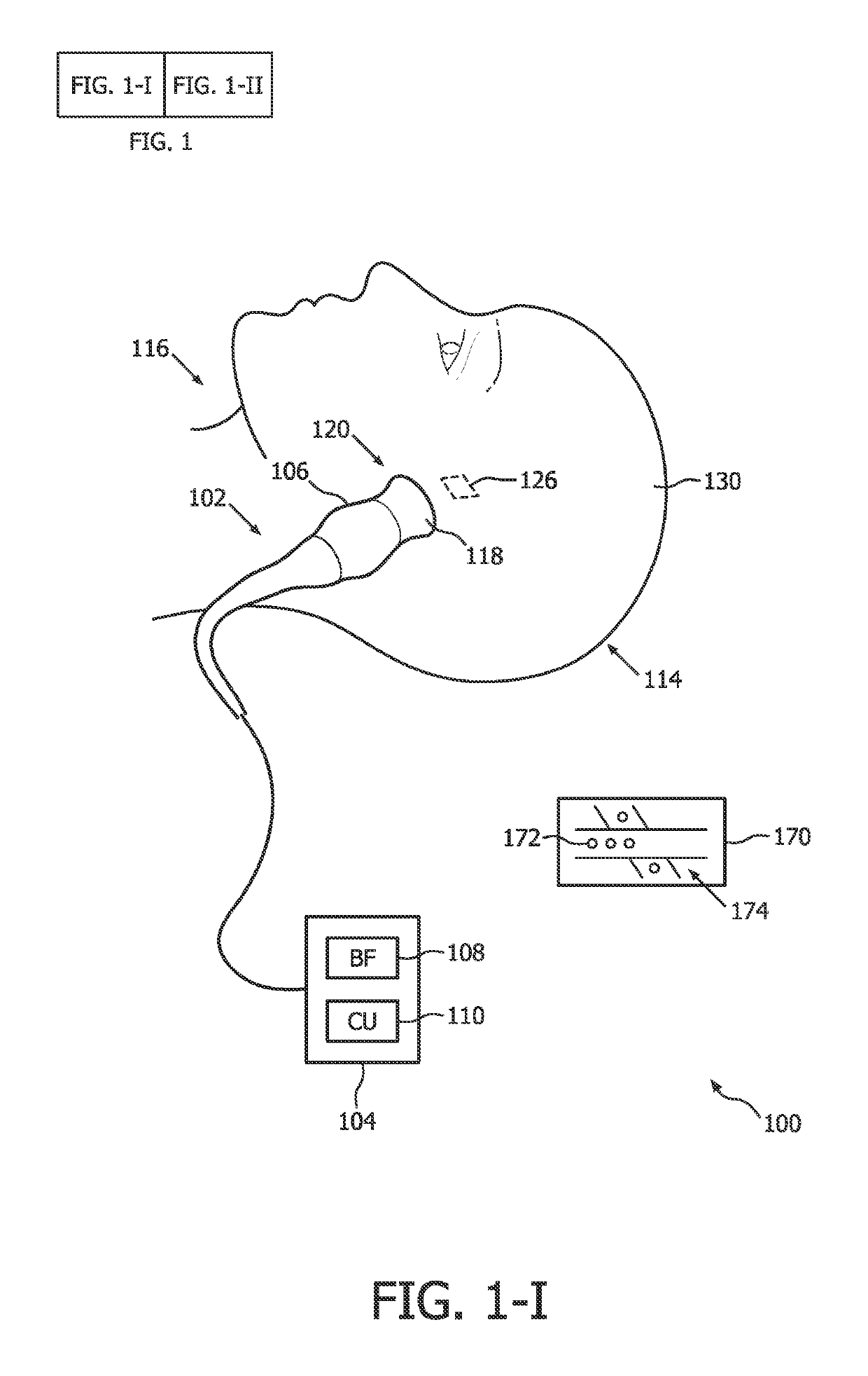 Microbubble signal based temporal-bone thickness compensation for sonothrombolysis