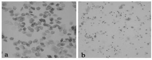 Traditional Chinese medicine composition for treating osteoporosis caused by breast cancer treatment, traditional Chinese medicine preparation and application