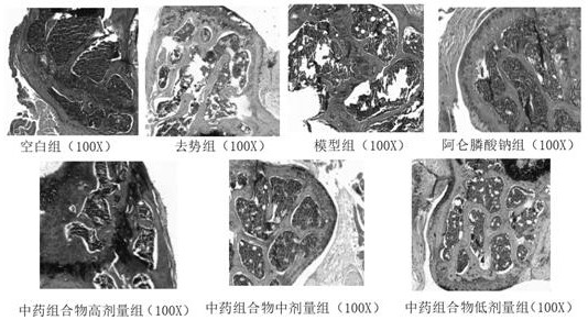 Traditional Chinese medicine composition for treating osteoporosis caused by breast cancer treatment, traditional Chinese medicine preparation and application