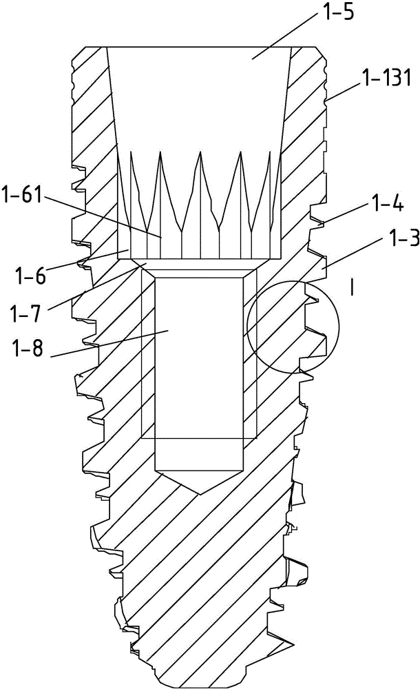 Implant system with straight base station