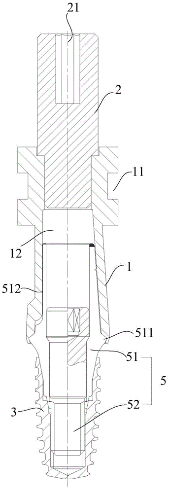 Impression auxiliary cap for dental implant surgery, and impression method