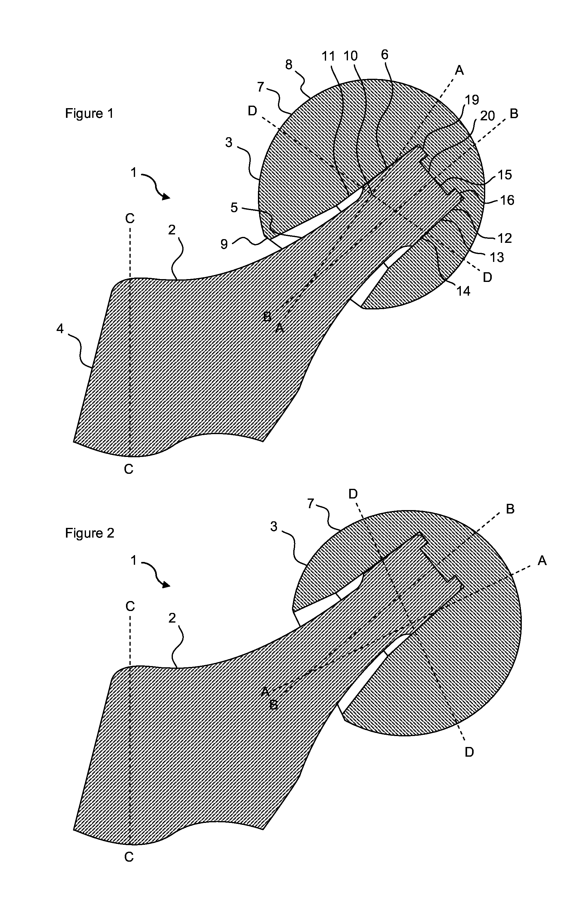 Femoral prosthesis with an offset head