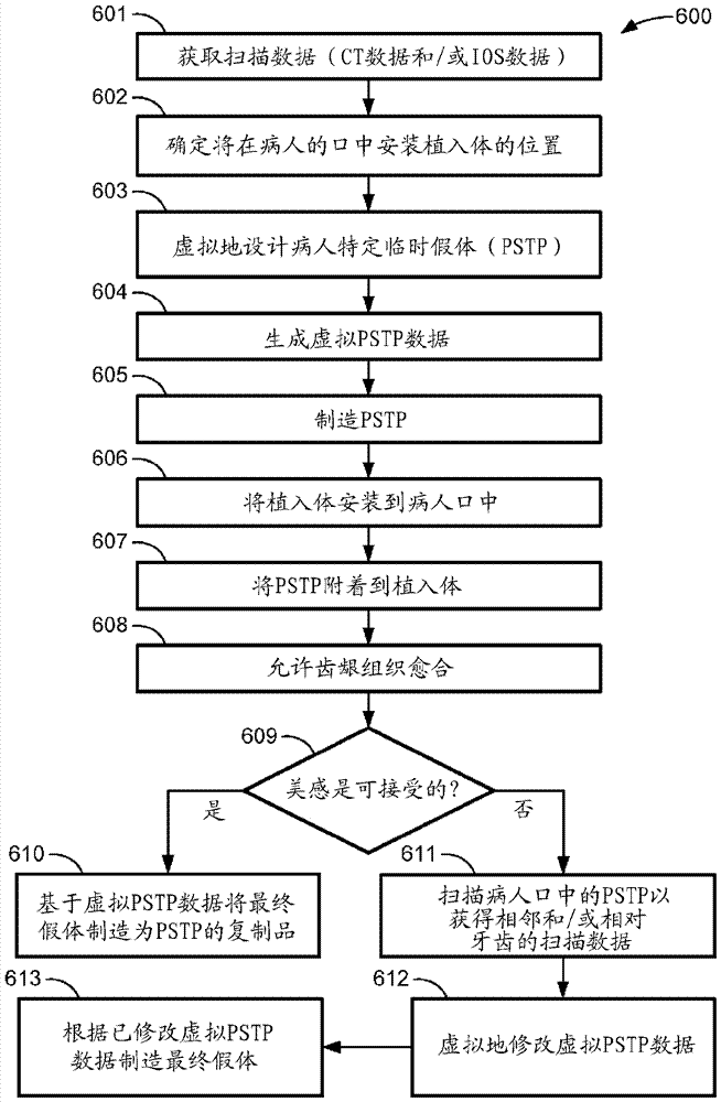 Temporary dental prosthesis for use in developing final dental prosthesis