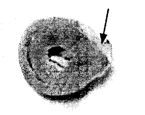 Application of radioisotope-labeled meso-position dianthrone compound in preparation of drug for detecting myocardial activity