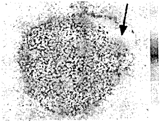 Application of radioisotope-labeled meso-position dianthrone compound in preparation of drug for detecting myocardial activity