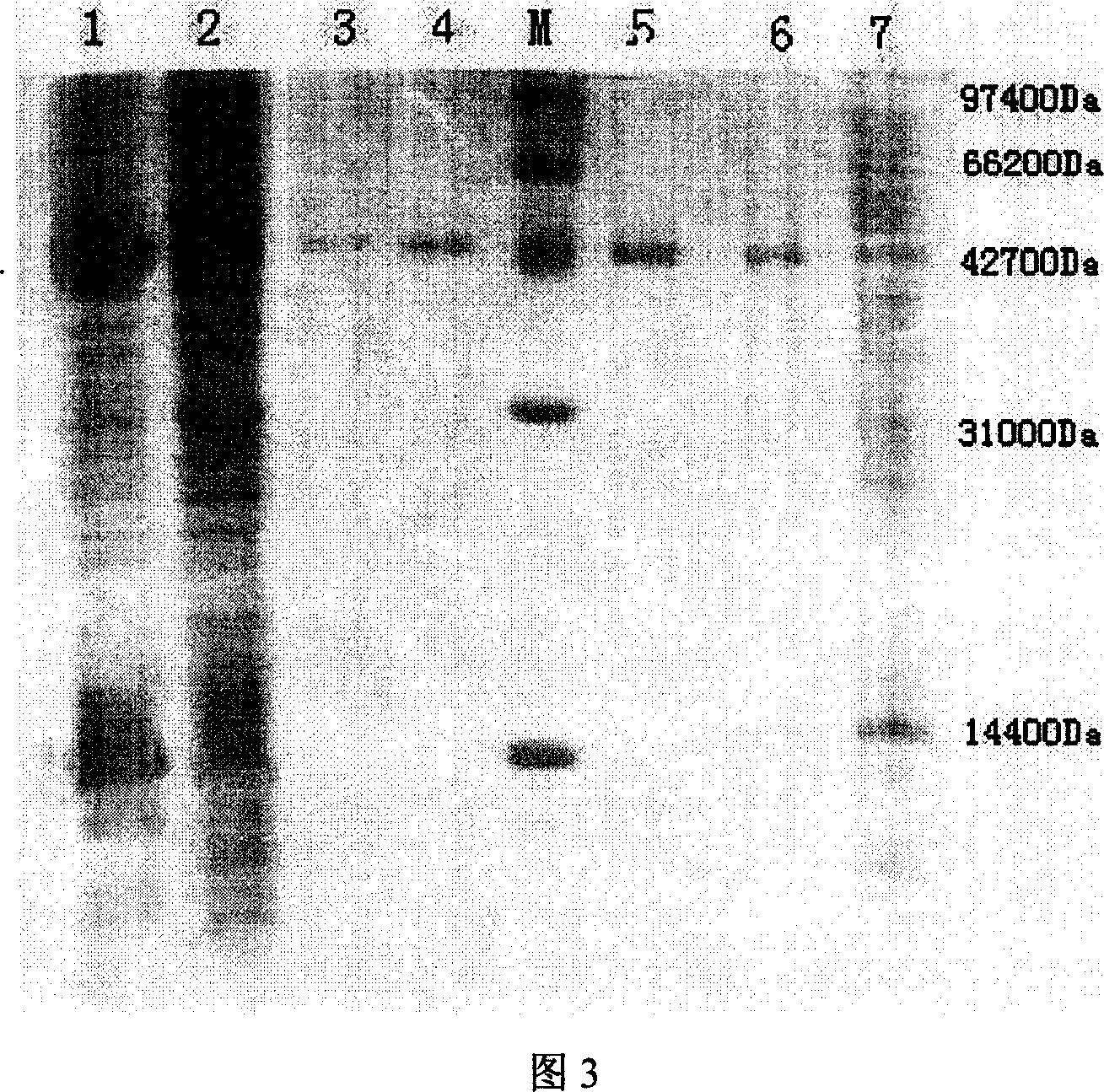 Engineering bacterium capable of producing 5-amino acetyl propionic acid in high yield