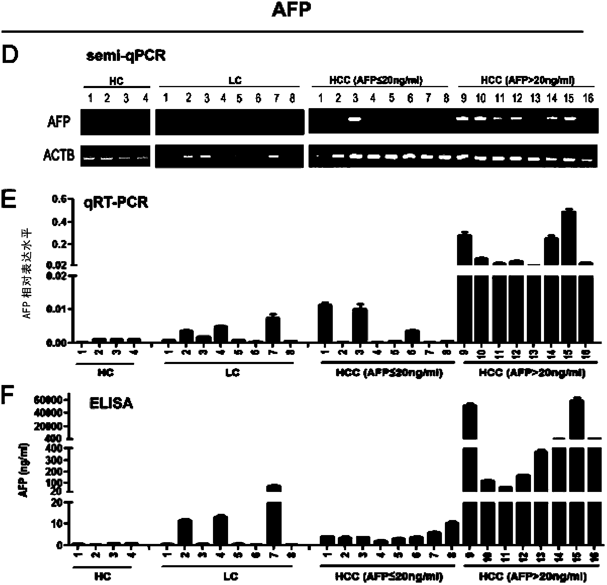 Application of DKK1 as diagnostic marker