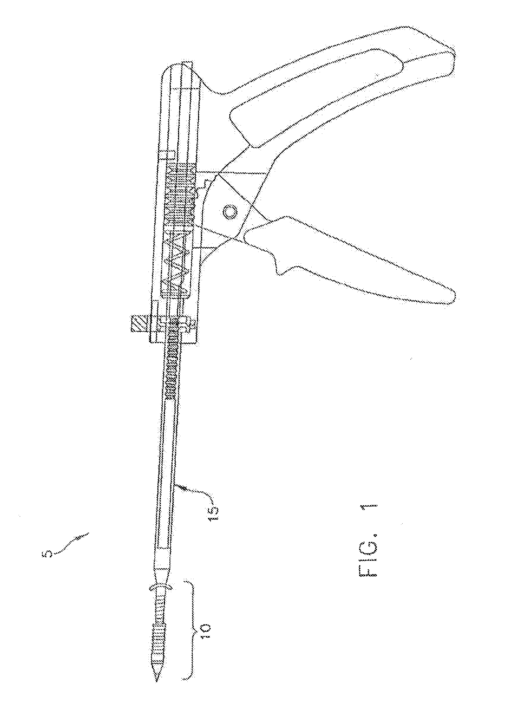 System And Method For Attaching Soft Tissue To Bone