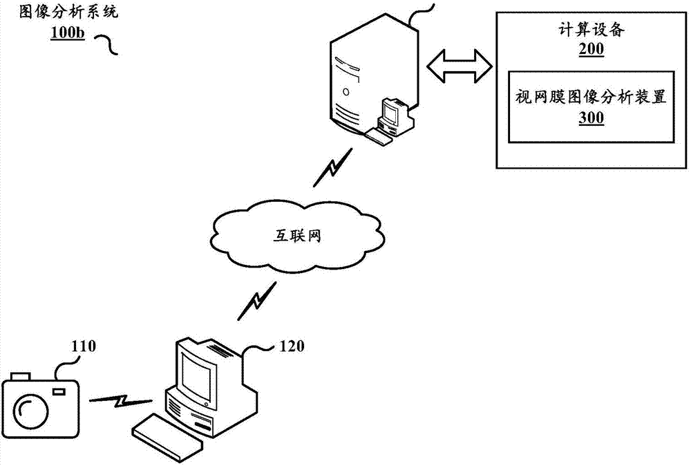 Retina image analysis method and device, and calculation equipment