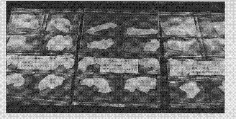 Laser micropore porcine acellular dermal matrix and preparation method thereof