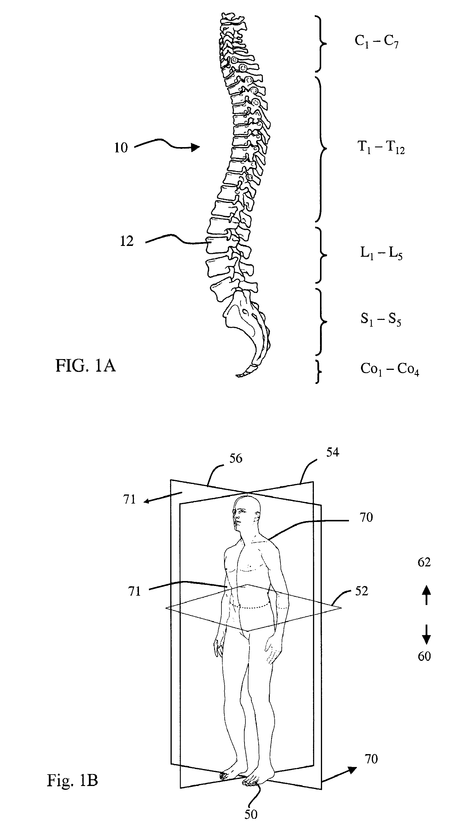 Devices, systems and methods for measuring and evaluating the motion and function of joint structures and associated muscles, determining suitability for orthopedic intervention, and evaluating efficacy of orthopedic intervention