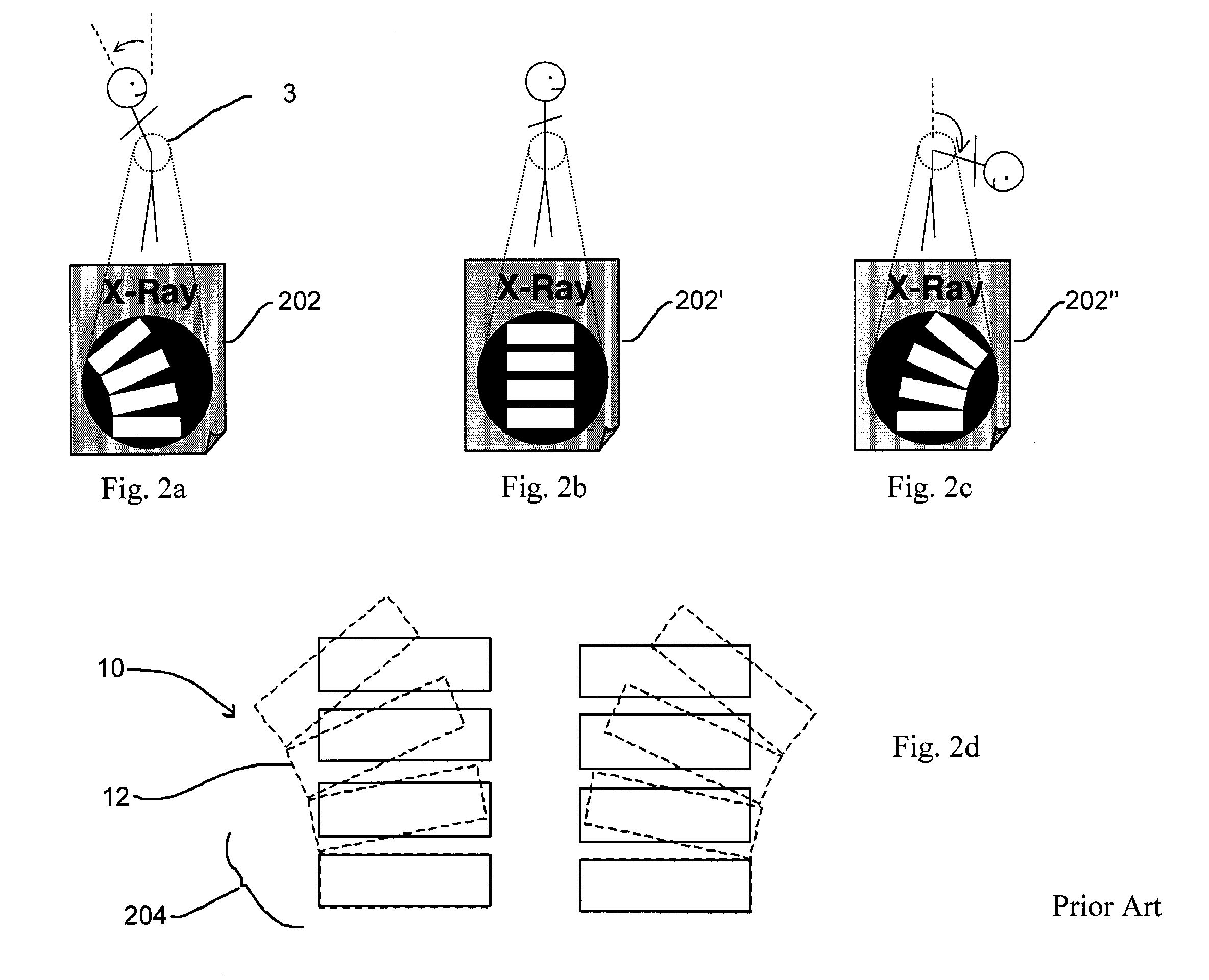 Devices, systems and methods for measuring and evaluating the motion and function of joint structures and associated muscles, determining suitability for orthopedic intervention, and evaluating efficacy of orthopedic intervention