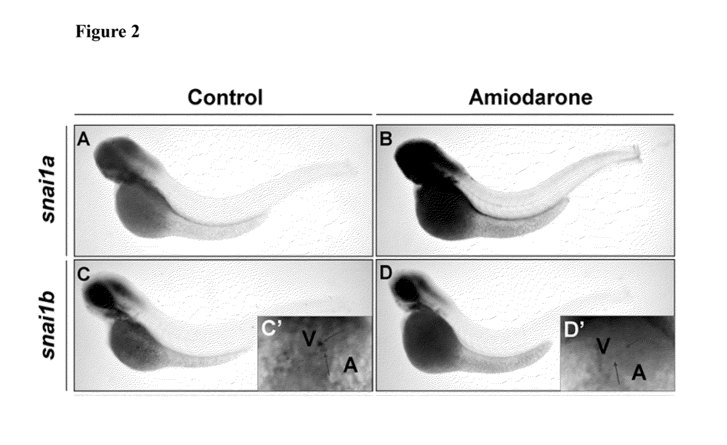 Method for inhibiting cancer metastasis by amiodarone