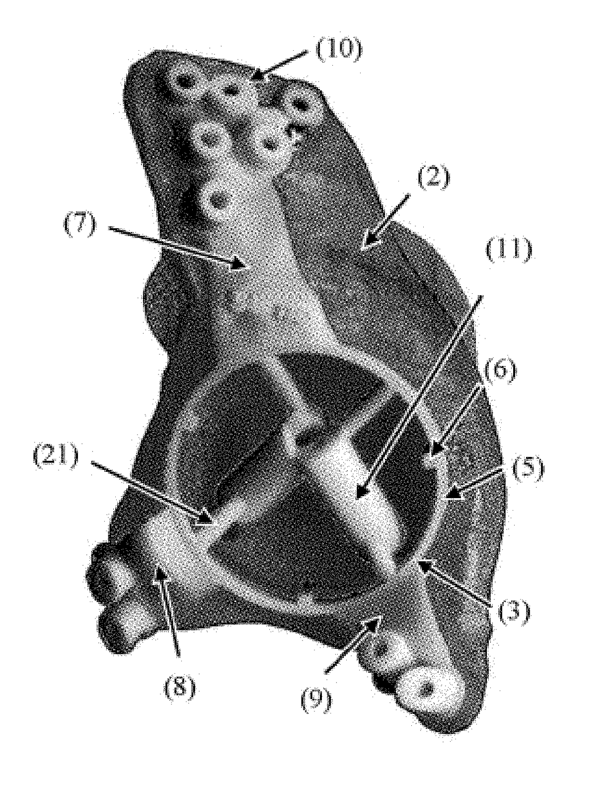 Customized surgical guides, methods for manufacturing and uses thereof