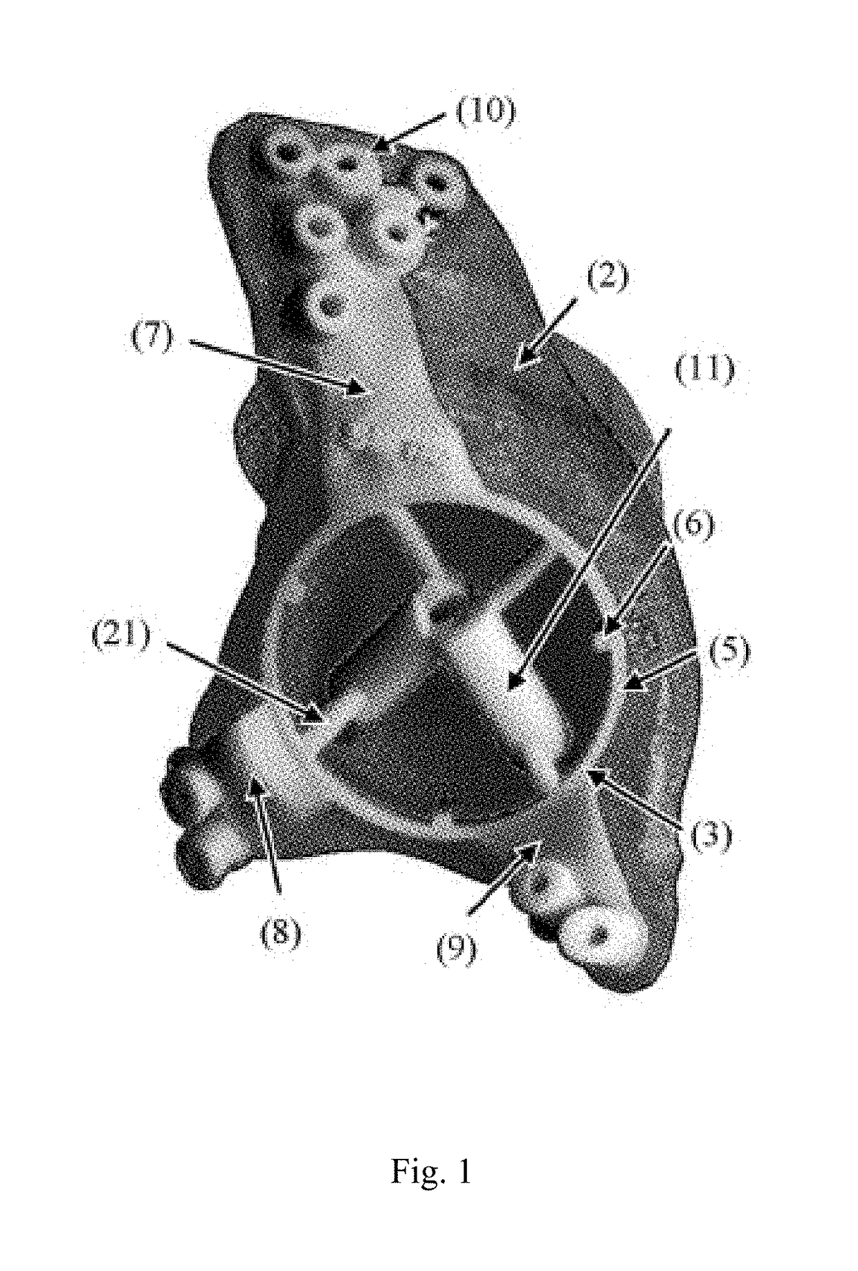 Customized surgical guides, methods for manufacturing and uses thereof