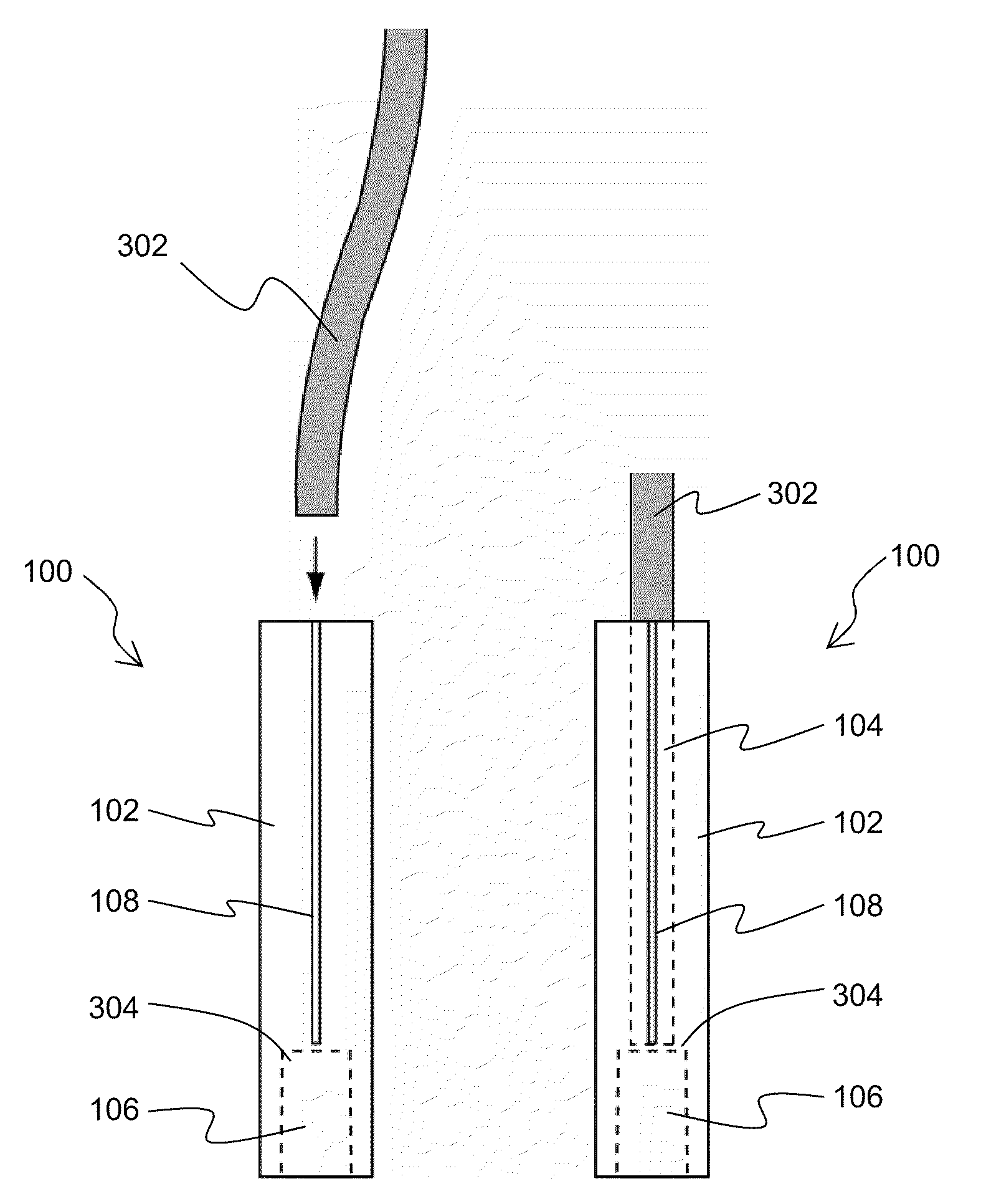 Endoscope Tip Protector