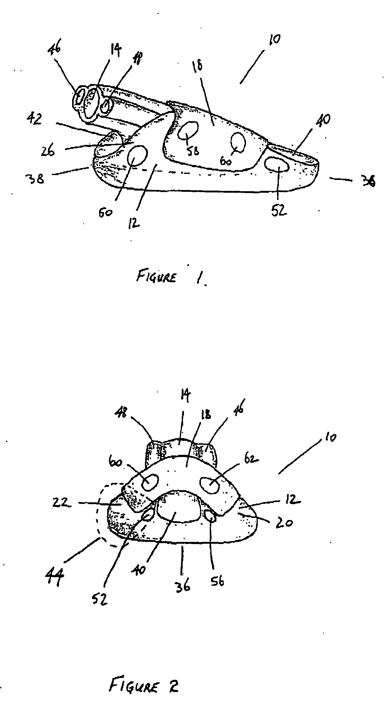 Laryngeal mask