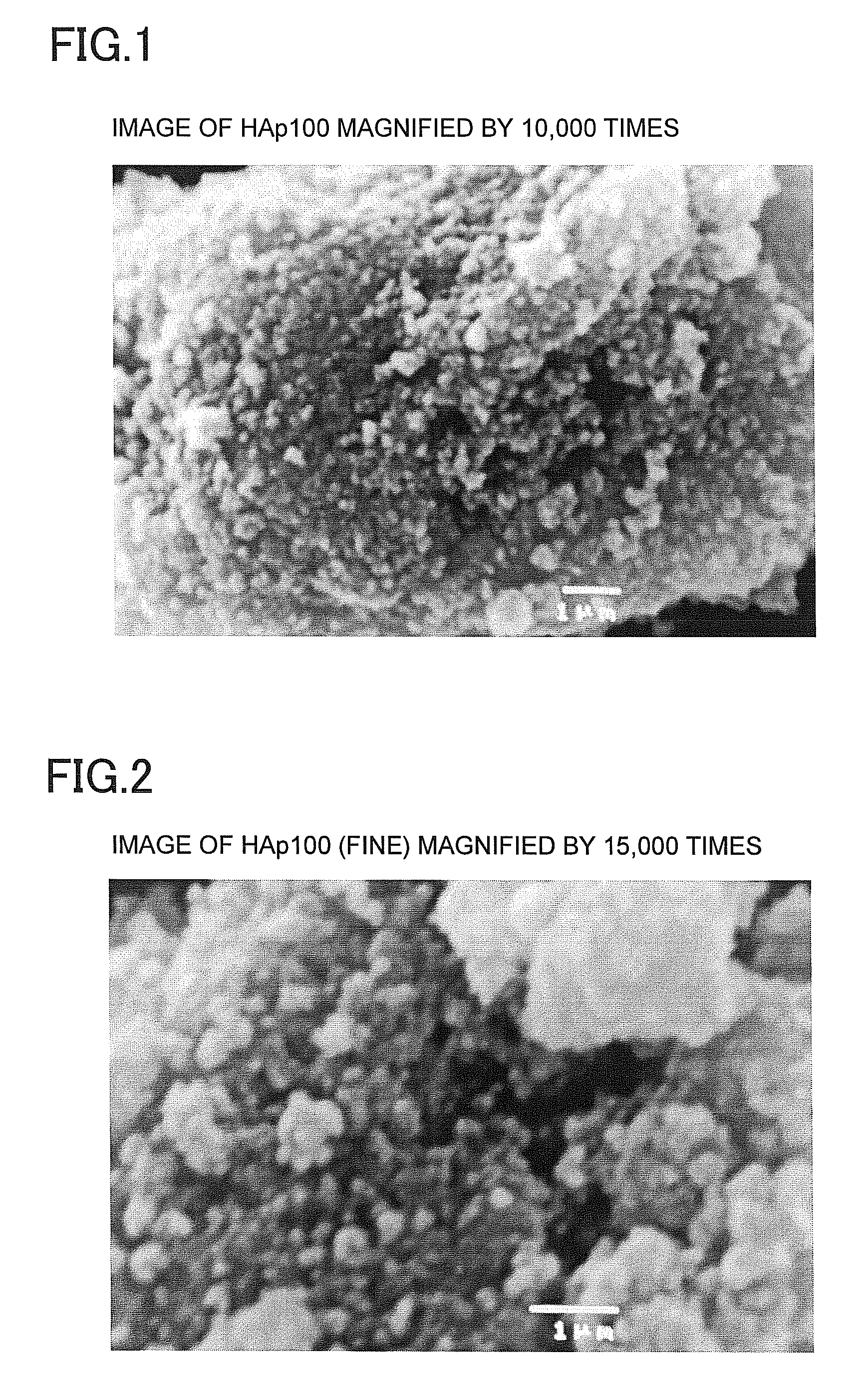 Chemically-curing type glass ionomer cement