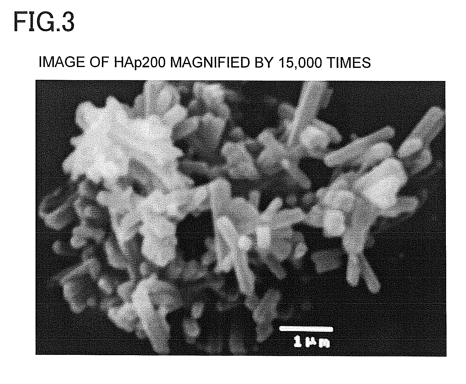 Chemically-curing type glass ionomer cement