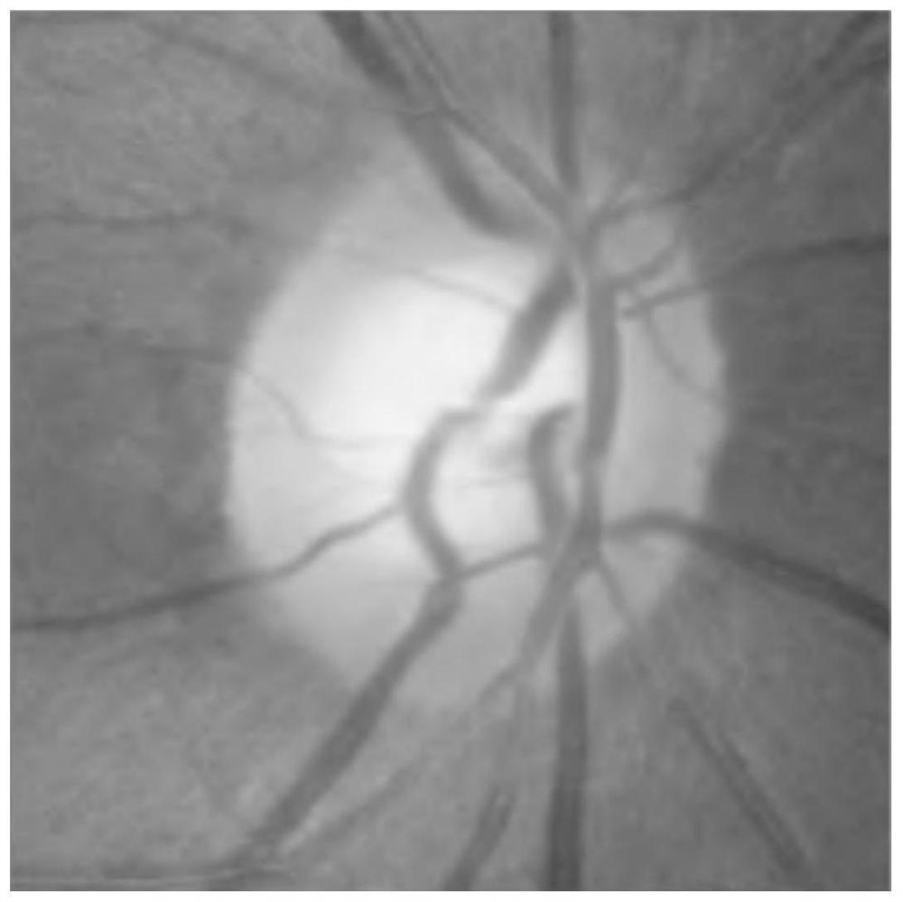 Visual cup and optic disc segmentation method based on depth level set learning