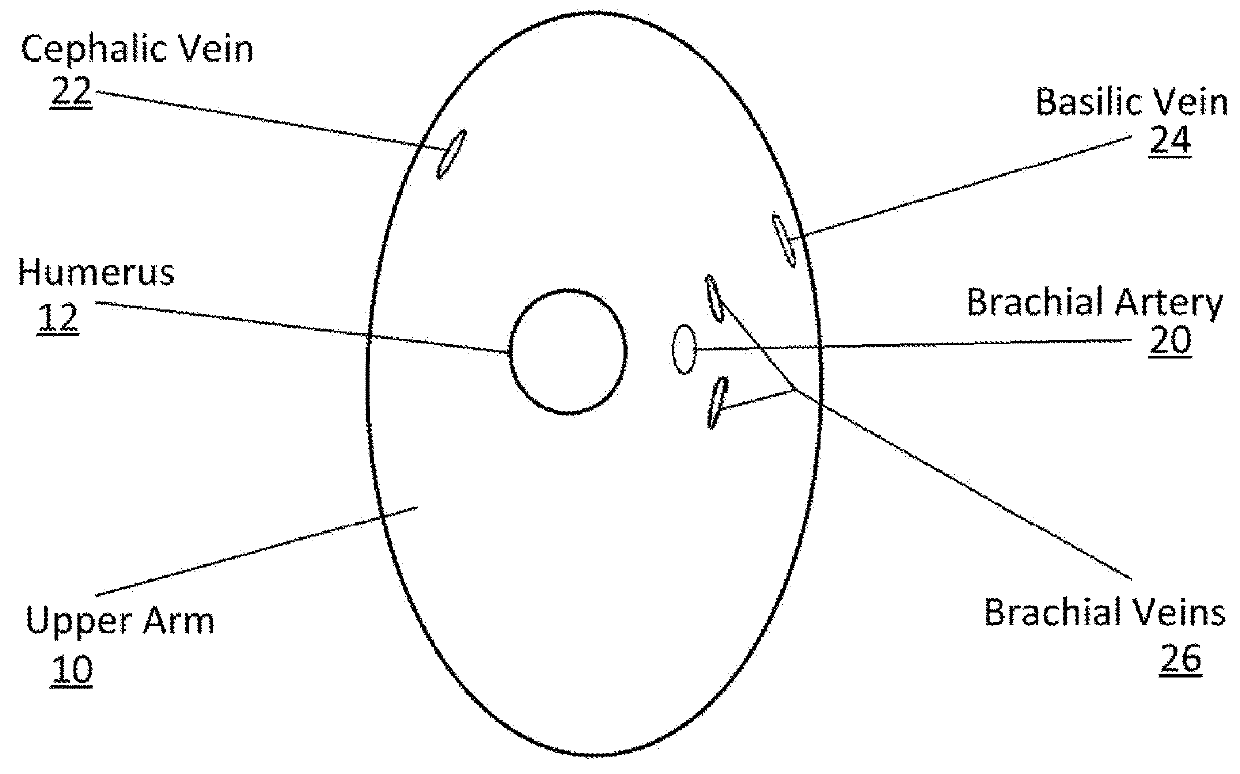 Clamping device for reducing venous blood flow