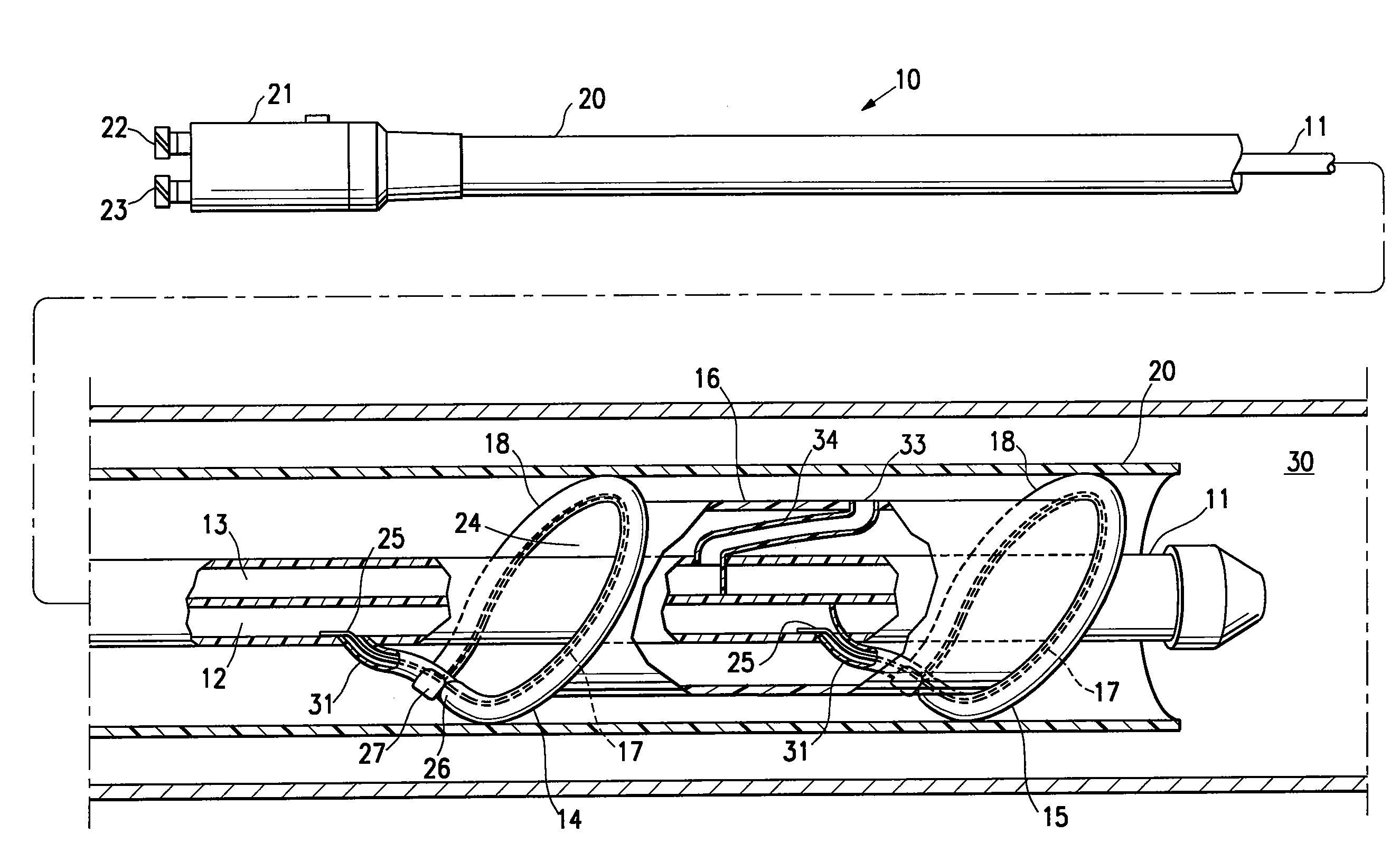 Agent delivery perfusion catheter