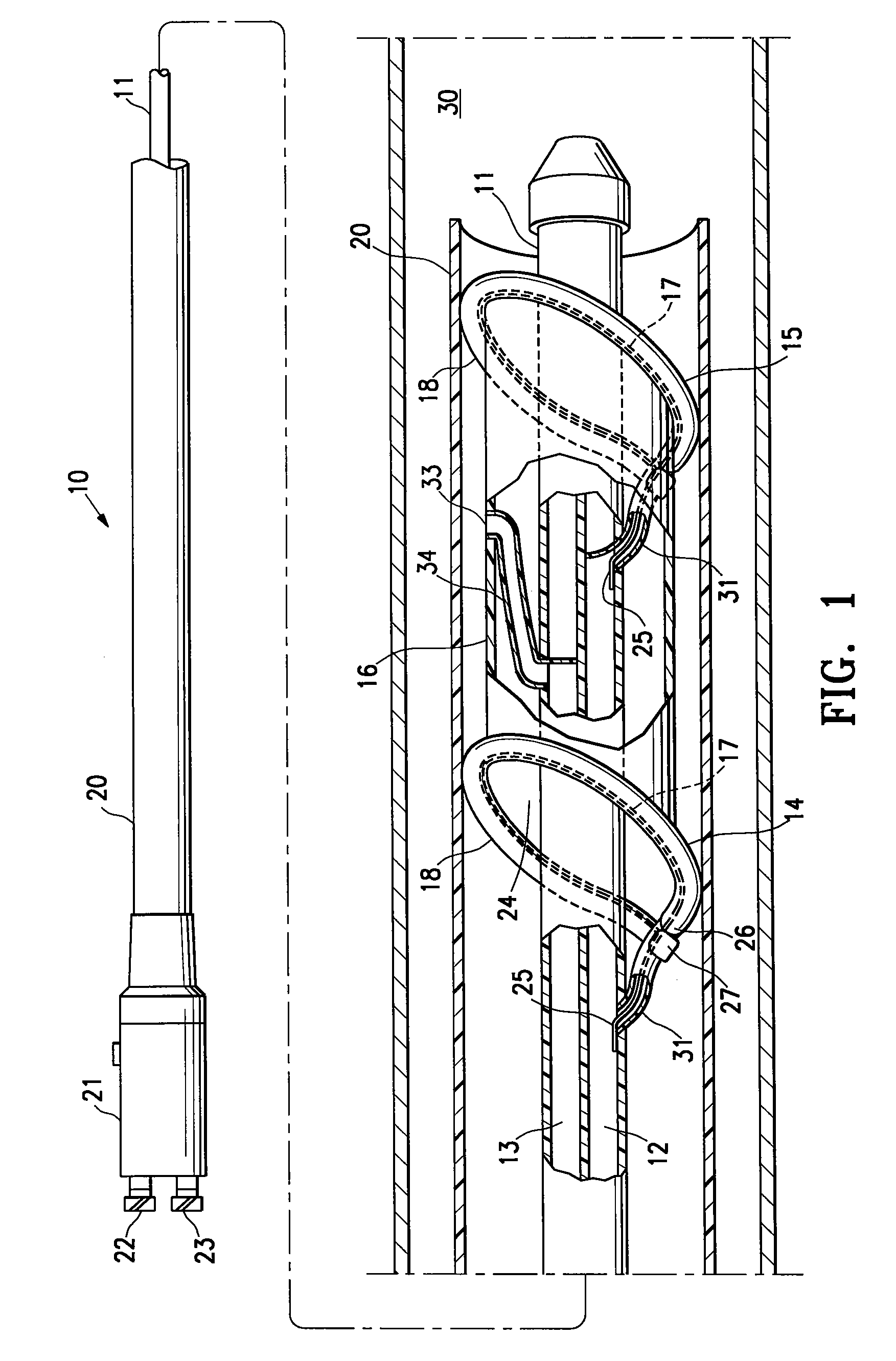 Agent delivery perfusion catheter