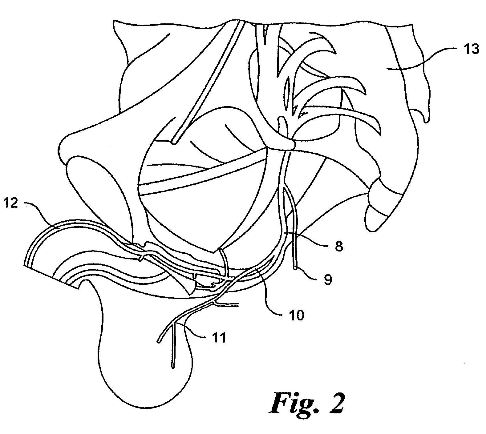 Therapeutic device for thermally assisted urinary function