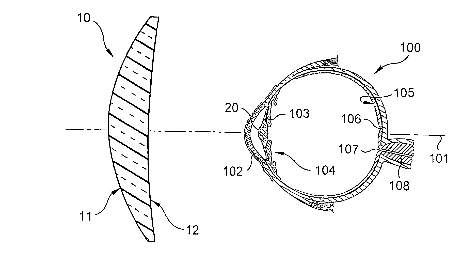 Optical accommodative compensation system