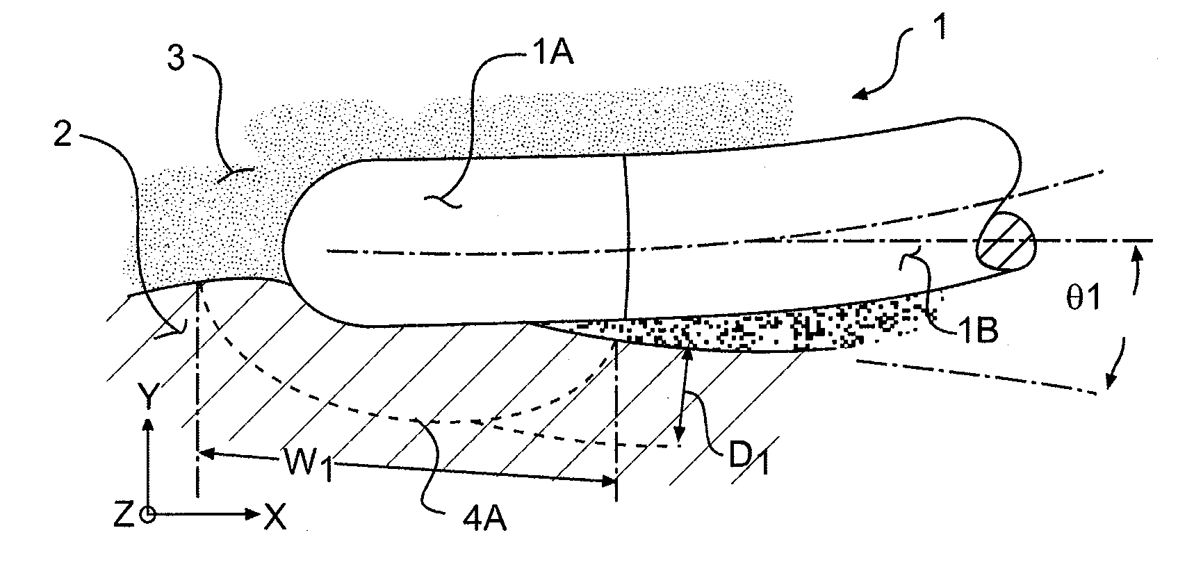 Arrangement and interface for RF ablation system with acoustic feedback